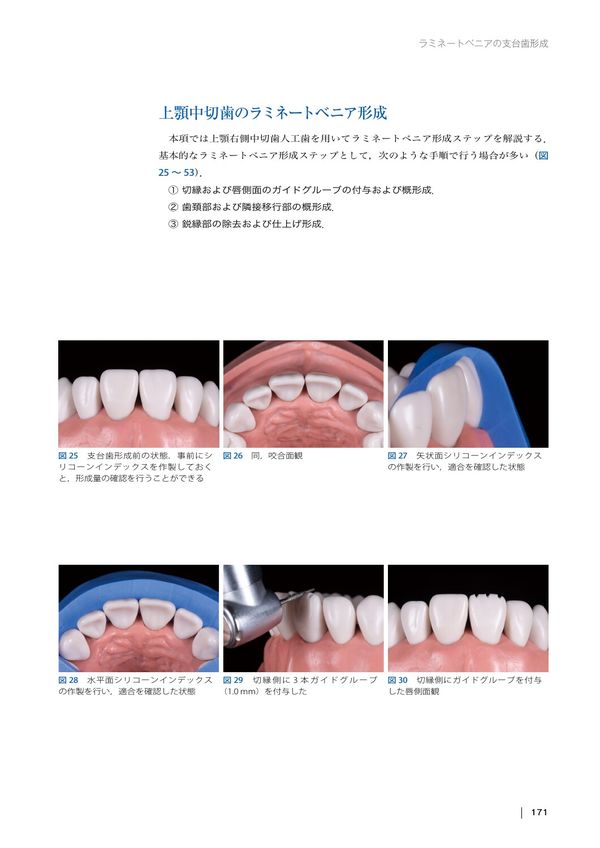 The Tooth Preparation 岩田 淳(著) - 医歯薬出版 | 版元ドットコム