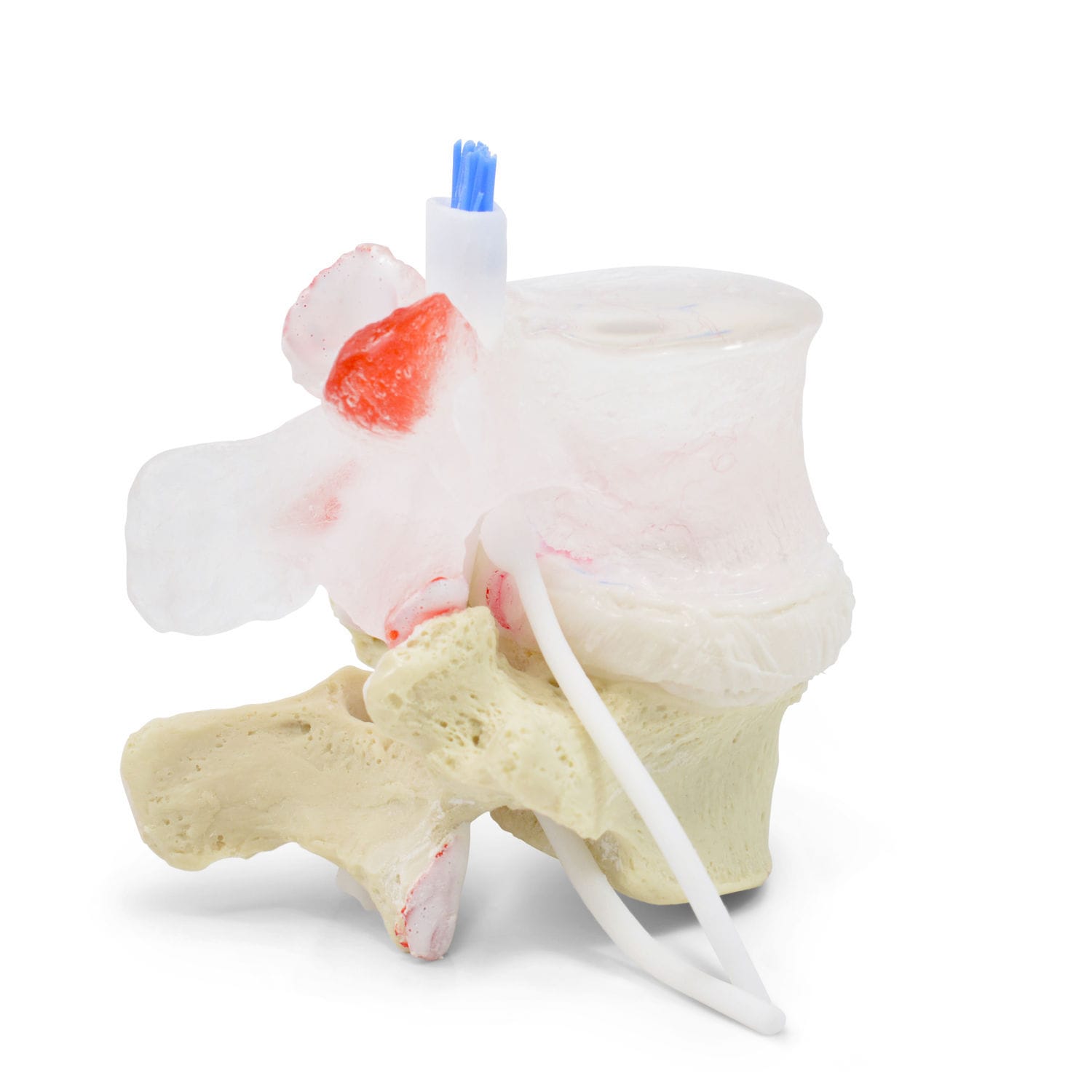 腰椎解剖模型- Professional LxH - Dynamic Disc Designs Corp