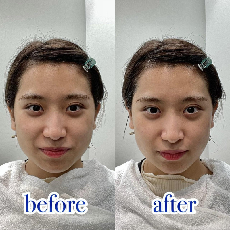 マツコの知らない世界でも紹介】まるでハイフ？全身の造形美を叶える