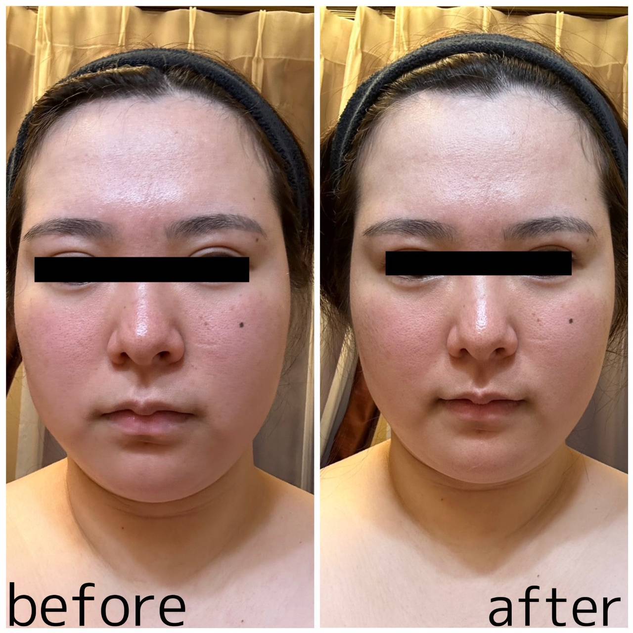 ドクタージェーナ(Dr.Jena)｜ホットペッパービューティー