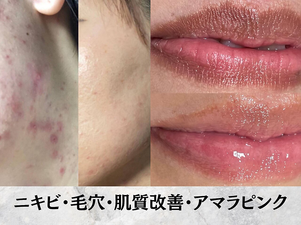 エステティックス ナインワンワン 横浜(Esthetics911