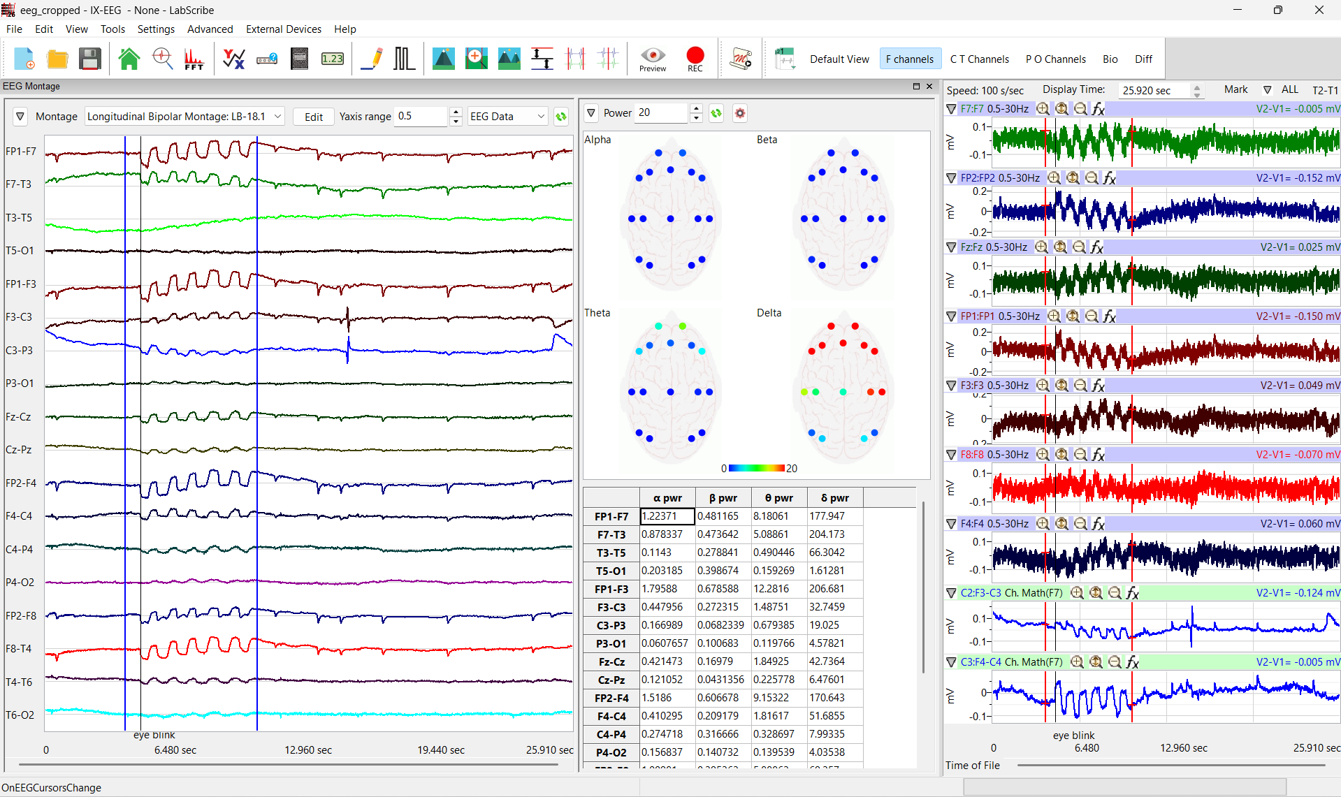 IX-EEG 10-20 System EEG Recorder - iWorx Systems, Inc.