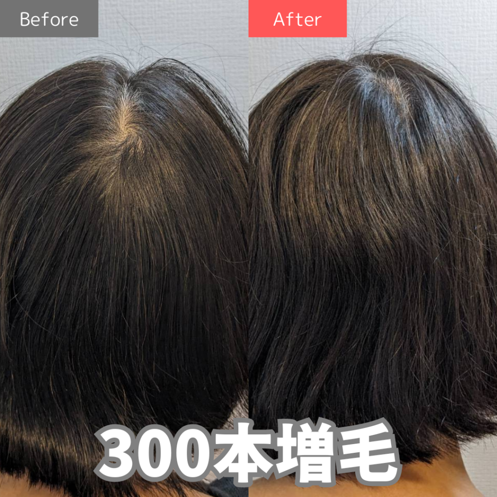 Felisa鹿児島中央駅前店】増毛技術「増毛エクステ」を開始しました