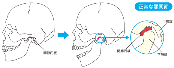 顎関節症福島区の歯医者｜かきうち歯科矯正歯科｜野田阪神徒歩4分