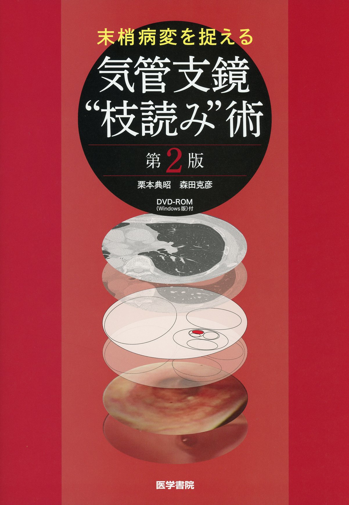 末梢病変を捉える 気管支鏡“枝読み”術 [DVD-ROM（Windows版）付] 第2版