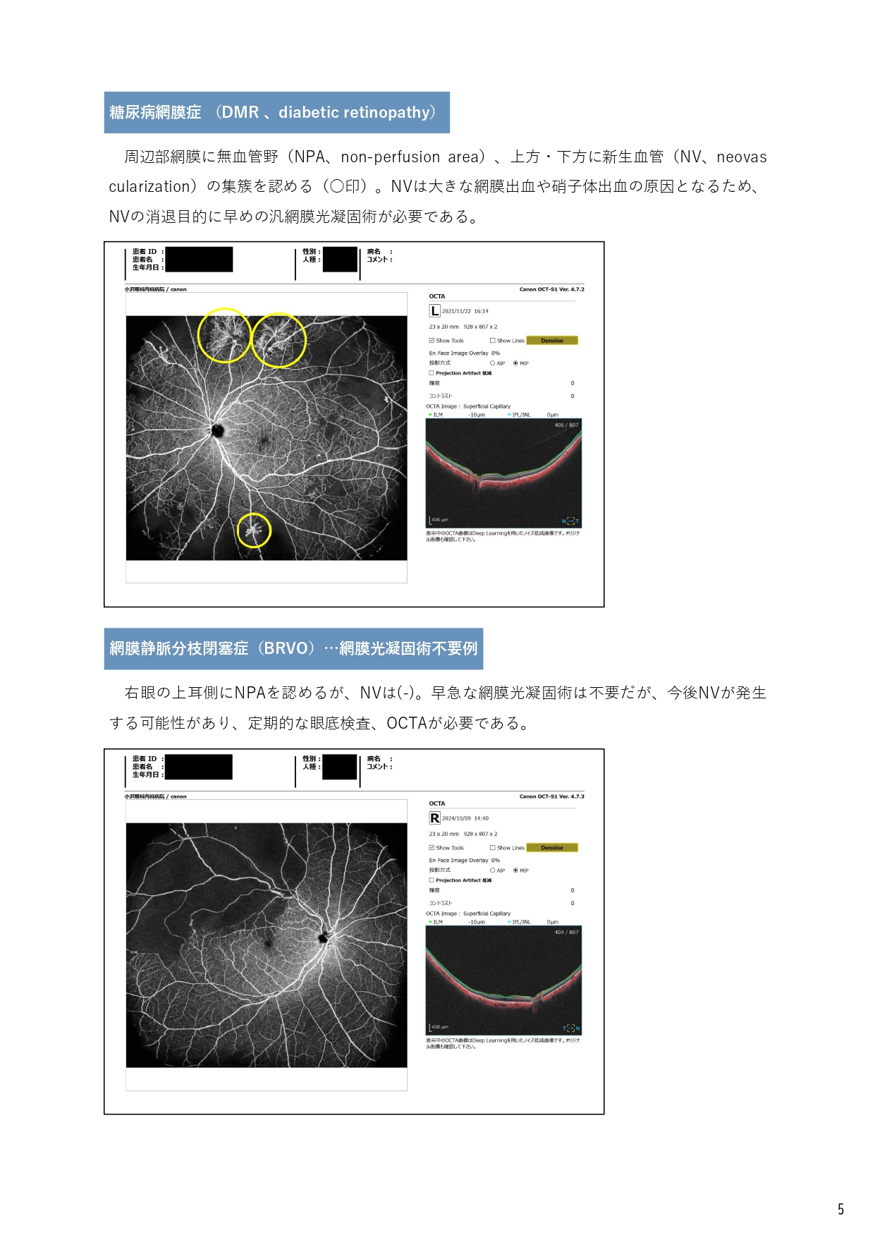 病院広報誌 2024.12 Eye love you 発行のお知らせ - 小沢眼科内科病院