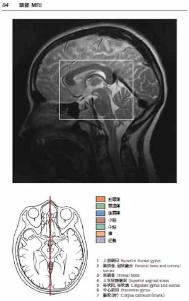 CT/MRI画像解剖ポケットアトラス 第3版 第1巻 頭部・頸部 | 町田 徹