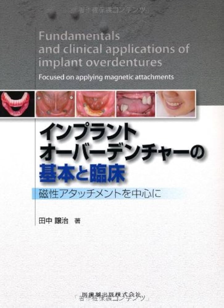 ♧裁断済 インプラントオーバーデンチャーの基本と臨床 インプラント