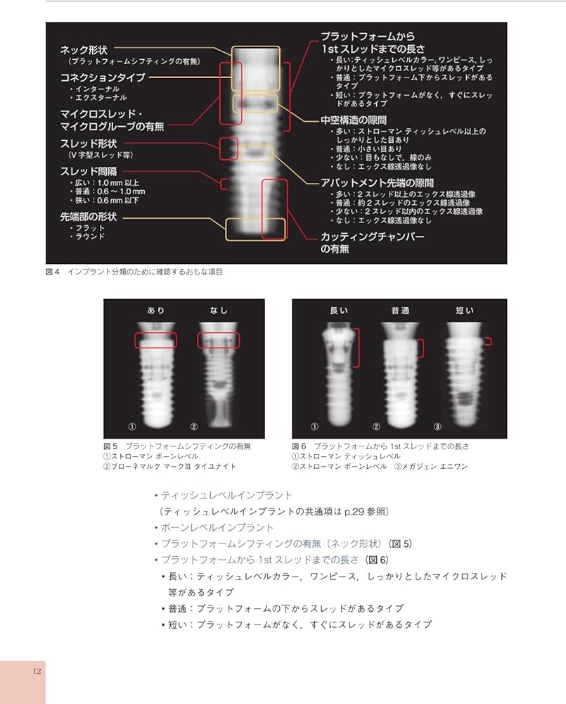 インプラント判別ガイド | 竹島 明道, 田島 聖士 |本 | 通販 | Amazon