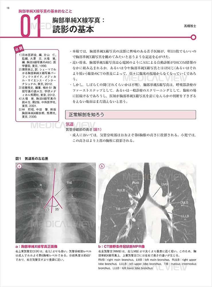 胸部 画像診断の勘ドコロNEO | 髙橋 雅士 |本 | 通販 | Amazon