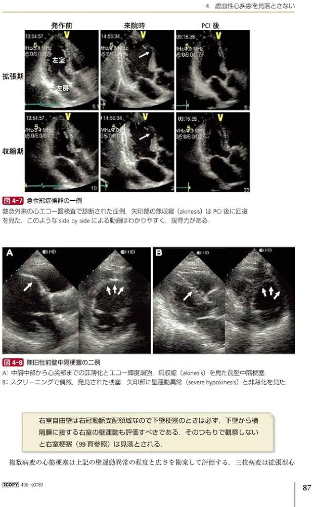 Amazon.co.jp: 新・心エコーの読み方，考え方 改訂4版 : 羽田 勝征