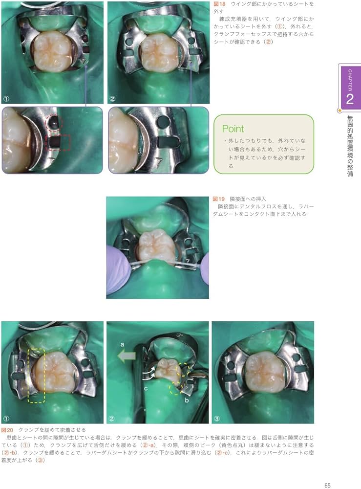 根管治療のクリニカルメソッド | 長谷川 智哉, 木方 一貴, 宮本 侑果