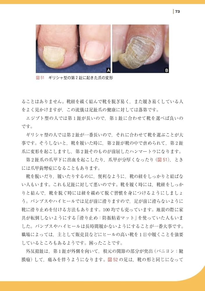 知っておきたい爪の知識と病気: すべての疑問を解決します! | 東 禹彦