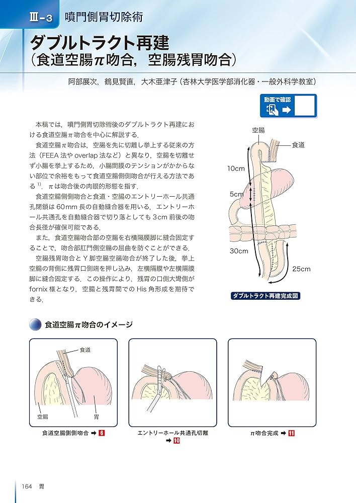 内視鏡外科消化器再建術のすべて | 阿部展次, 上野正紀, 江原一尚