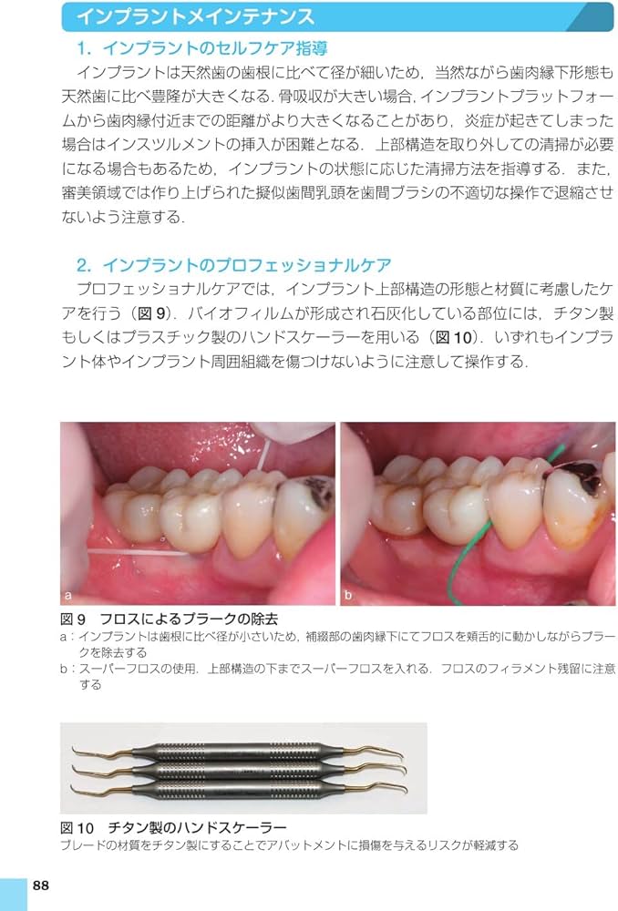 Amazon.co.jp: 歯科臨床まずはここから! 歯周治療: 卒後5年を支える