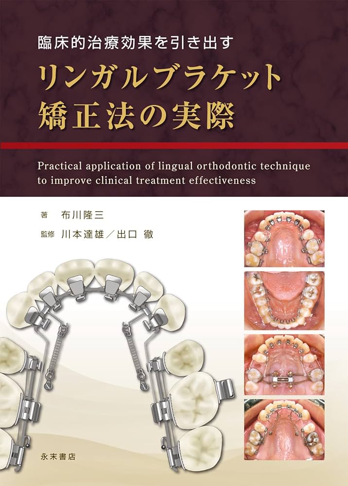 Amazon.co.jp: 臨床的治療効果を引き出す リンガルブラケット矯正法の