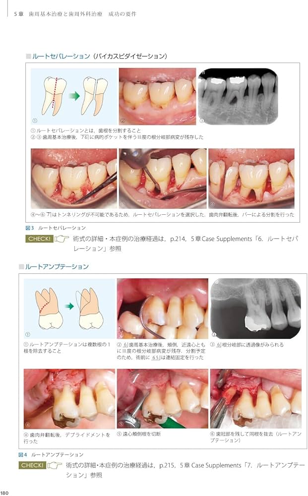 Dr.弘岡に訊く臨床的ペリオ講座 スカンジナビアンアプローチの実践
