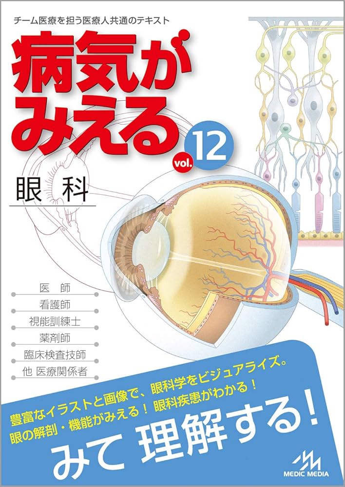 病気がみえる vol.12 眼科 第1版 | 医療情報科学研究所 |本 | 通販