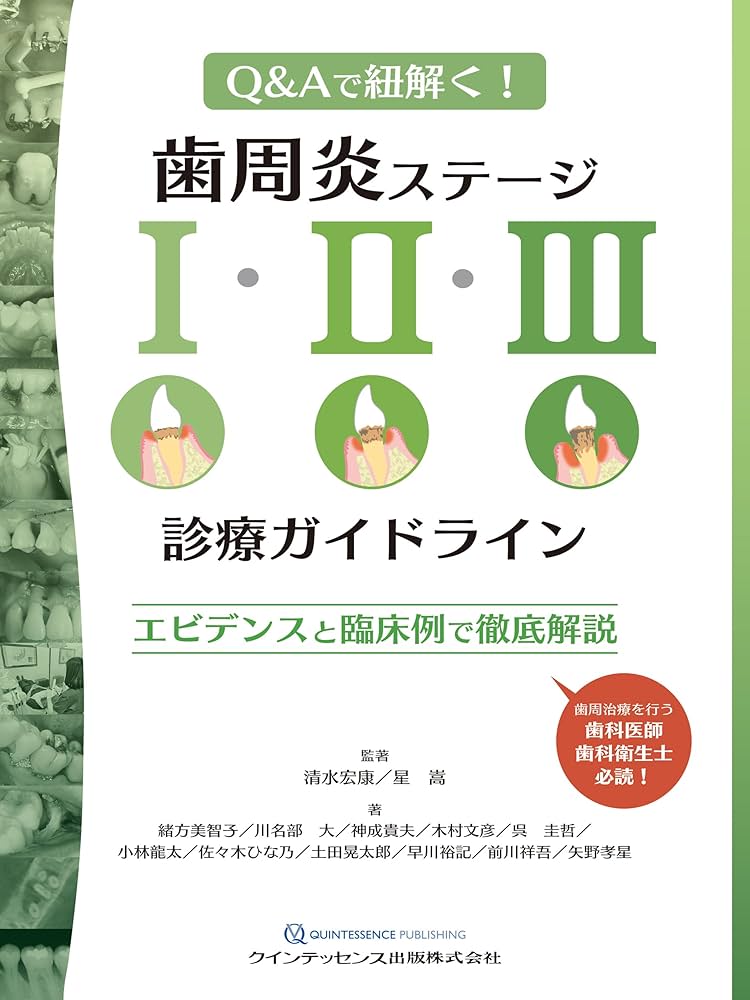歯周炎ステージI・II・III診療ガイドライン: エビデンスと臨床例で徹底