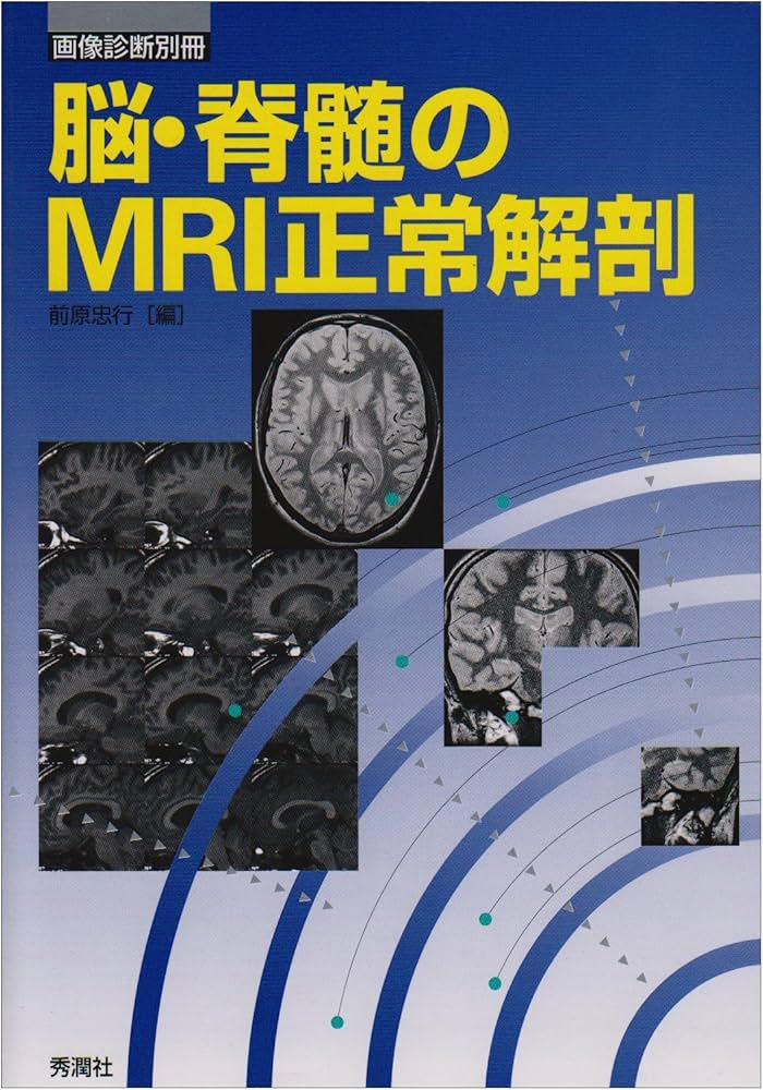 脳・脊髄のMRI正常解剖 (画像診断別冊) | 前原 忠行 |本 | 通販 | Amazon