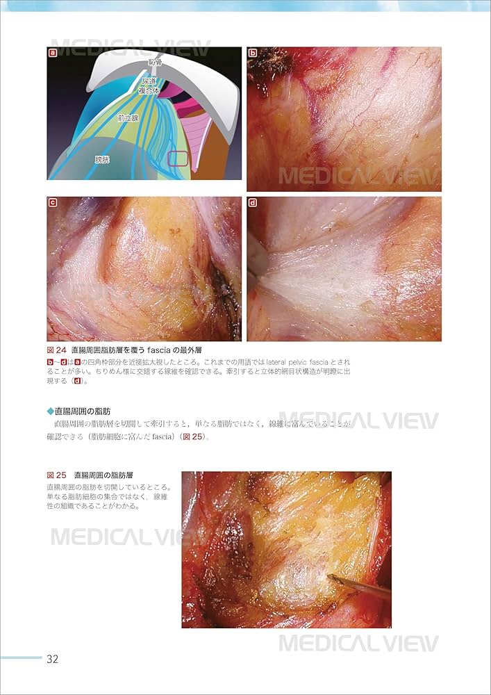 816ihSoitSL._AC_UF1000,