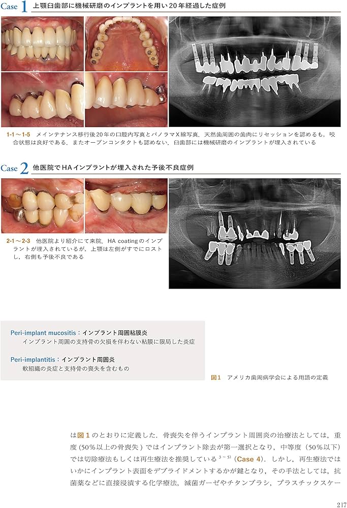 The Fabric of the Modern Implantology 近代インプラント治療の
