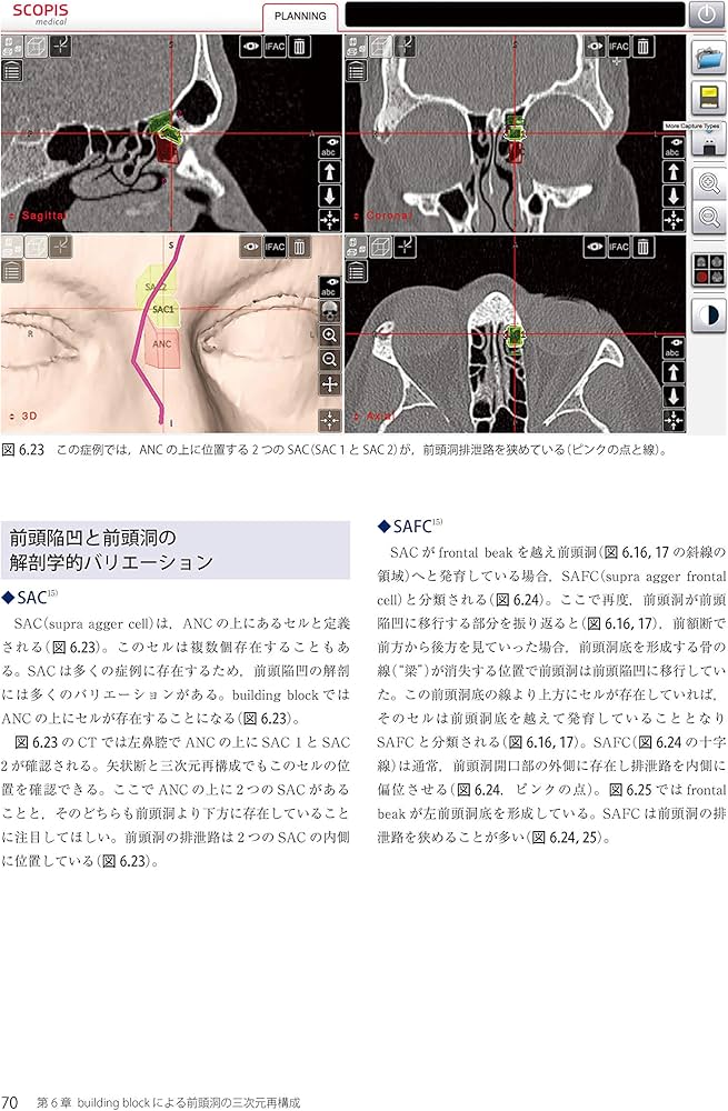 Amazon.co.jp: ウォーモルド内視鏡下鼻副鼻腔・頭蓋底手術 : 本間 明宏: 本