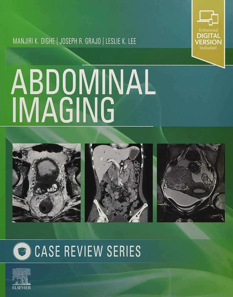 Abdominal Imaging: Case Review Series: 9780323679848: Medicine