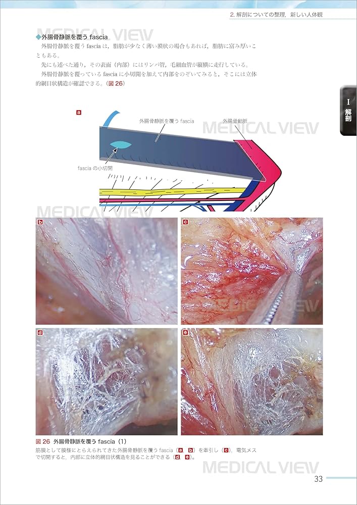 Amazon.co.jp: 根治のための前立腺全摘術の新しい考え方−最新の