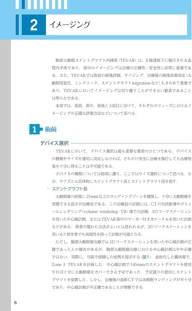 ステントグラフト内挿術マニュアル 胸部編 ─ 動画を含む電子版付