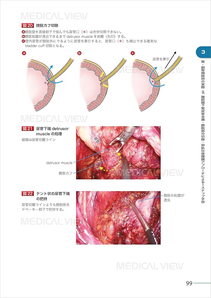 究める 腎・副腎腫瘍に対する腹腔鏡・ロボット支援手術［Web動画付