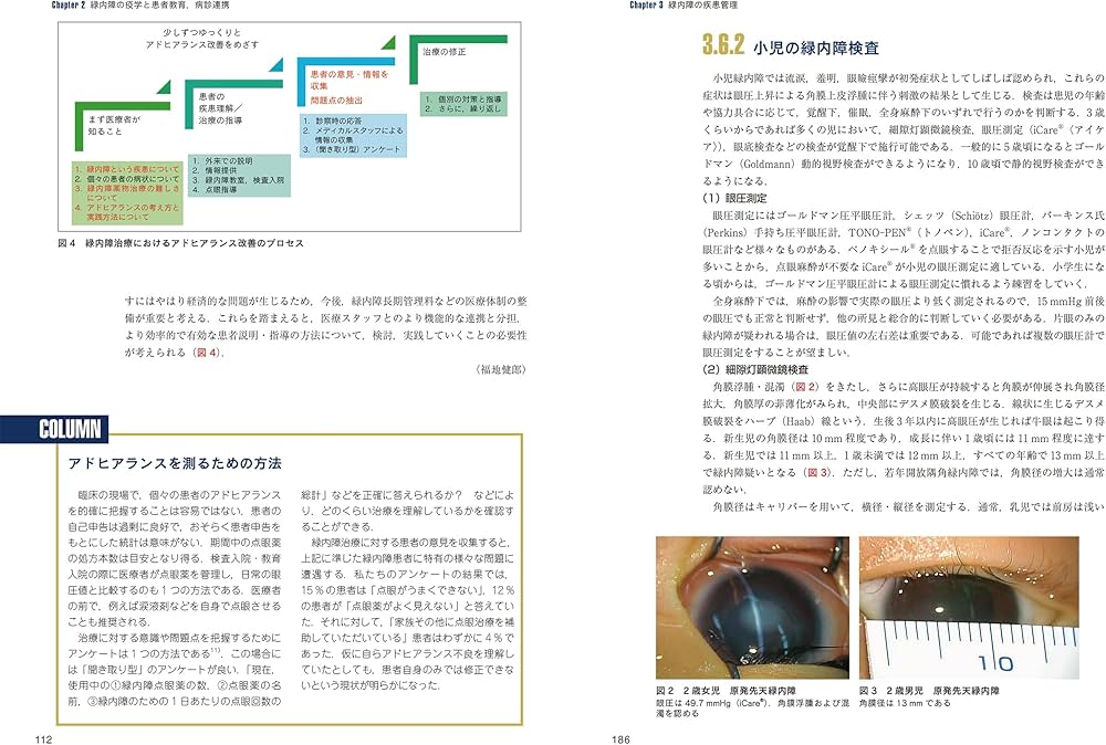 最新 緑内障診療パーフェクトガイドー患者教育から最新の手術治療まで
