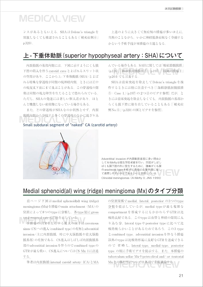 エッセンシャル頭蓋底外科−イラストとビデオで学ぶ頭蓋底中心部腫瘍の