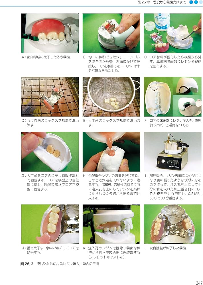 歯学生のパーシャルデンチャー 第6版 | 赤川 安正, 岡崎 定司, 志賀 博