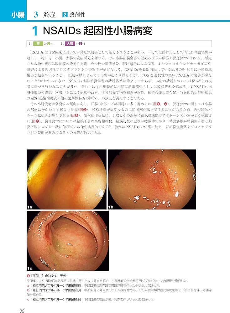 胃と腸アトラスII 下部消化管 第3版 | 「胃と腸」編集委員会, 松本 主