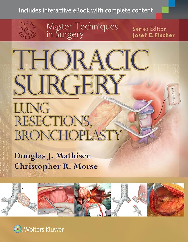 Master Techniques in Surgery: Thoracic Surgery: Lung Resections