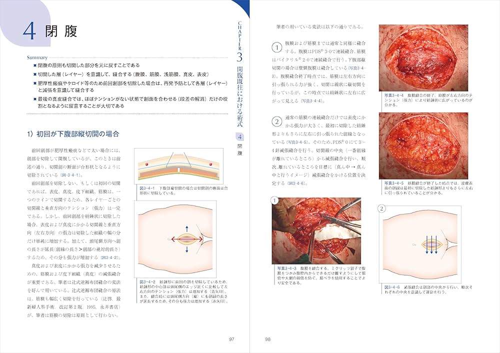 エキスパートこだわりの帝王切開術：理論＋根拠を押さえてコツを得る