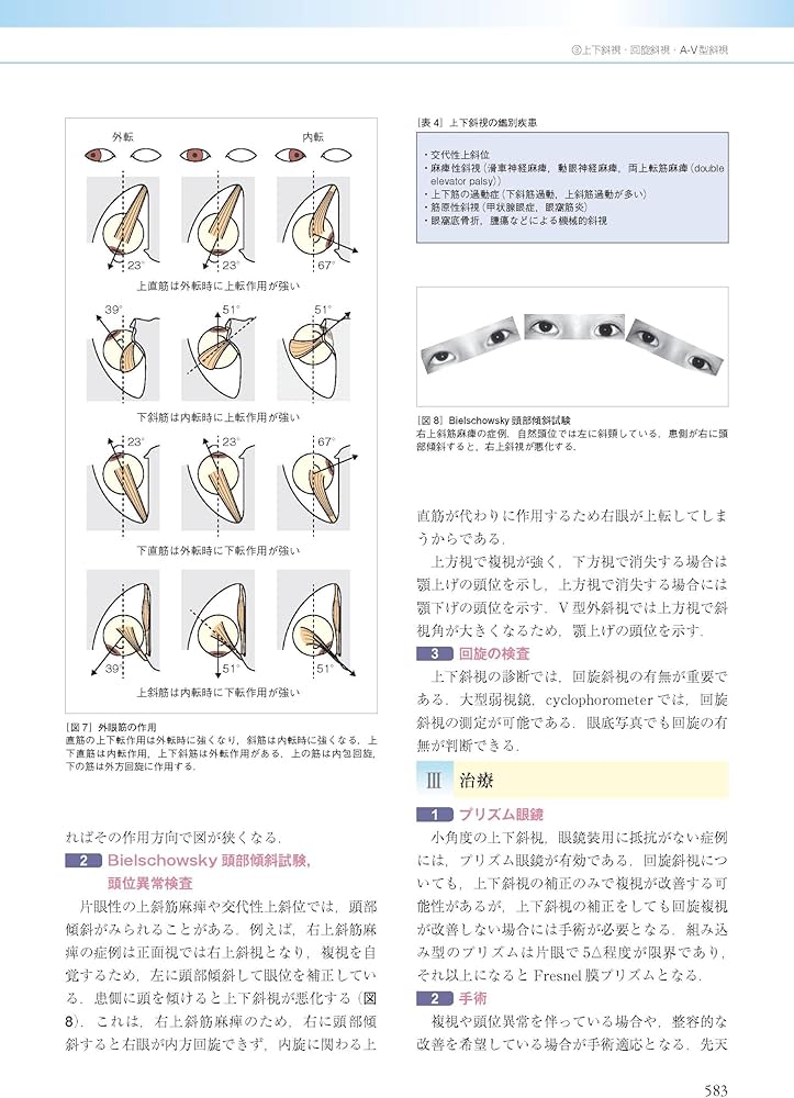 眼科診療ガイド 第2版 | 根木 昭 |本 | 通販 | Amazon
