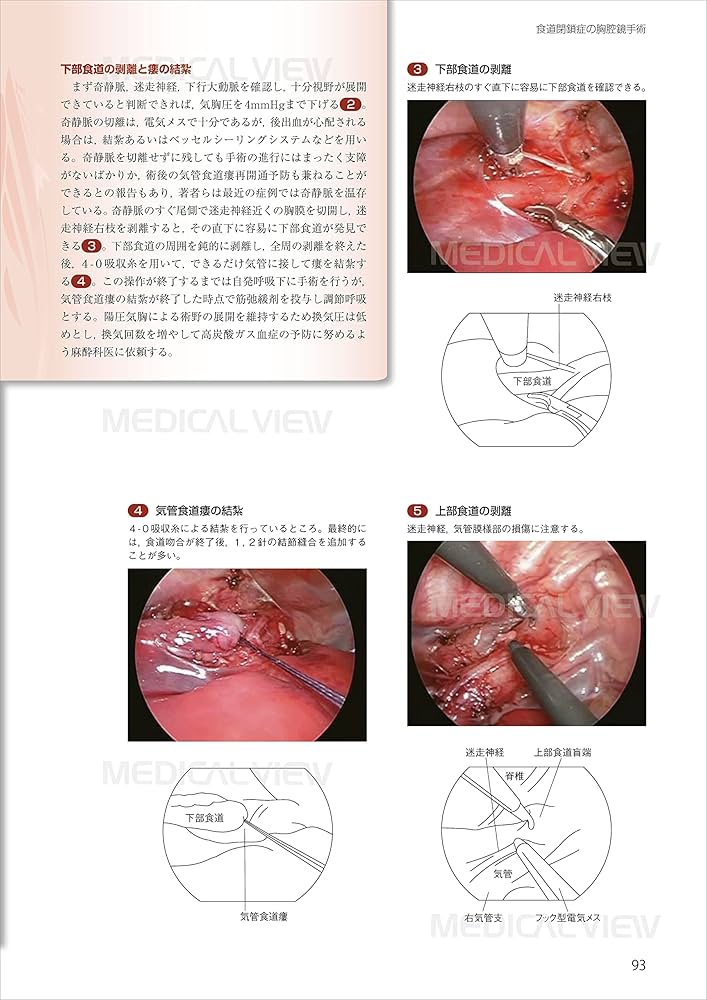 スタンダード小児外科手術 | 猪股 裕紀洋 |本 | 通販 | Amazon