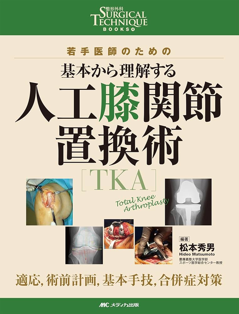 人工膝関節置換術[TKA]: 若手医師のための 基本から理解する/適応,術前