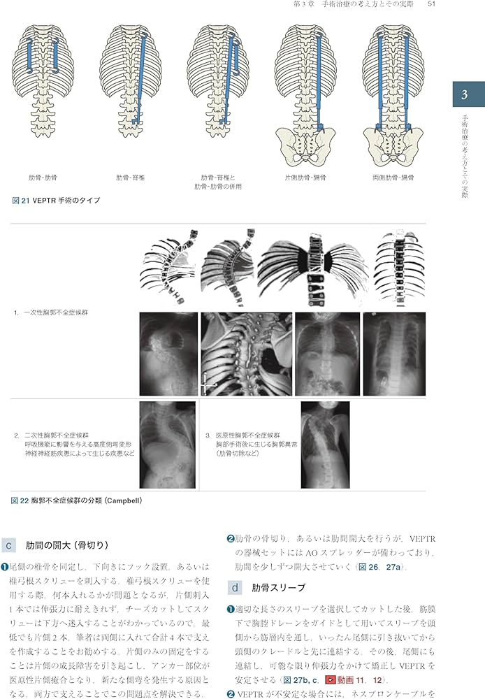 Amazon.co.jp: 症例から学ぶ小児脊柱変形（基礎から難治性疾患まで