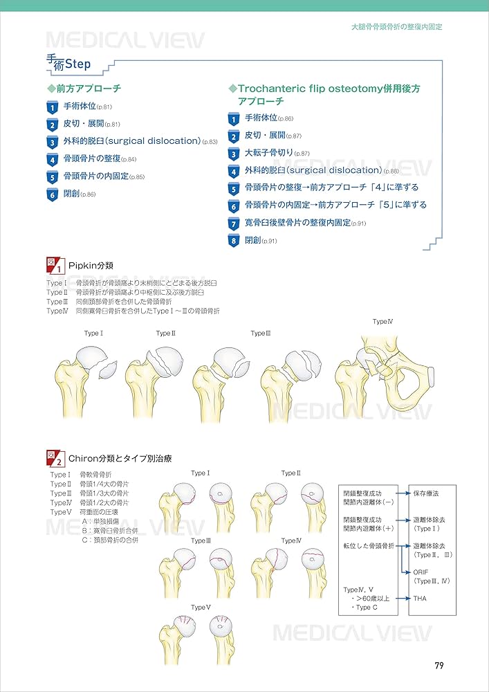 Amazon.co.jp: 下肢の骨折手術① 骨盤・大腿骨［Web動画付］ (新OS