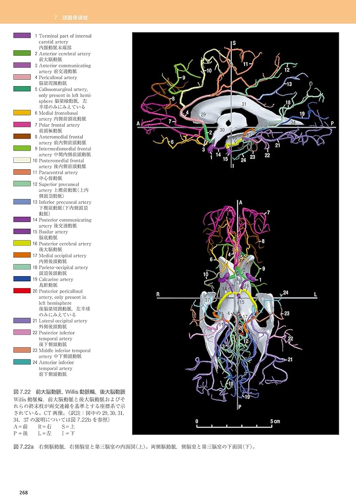 脳の機能解剖と画像診断 第2版 | 眞柳 佳昭 |本 | 通販 | Amazon