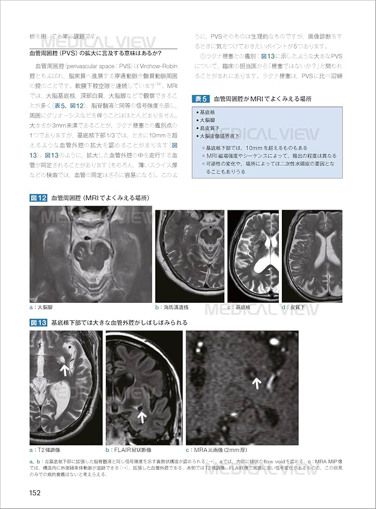画像で究める認知症 | 德丸 阿耶 |本 | 通販 | Amazon