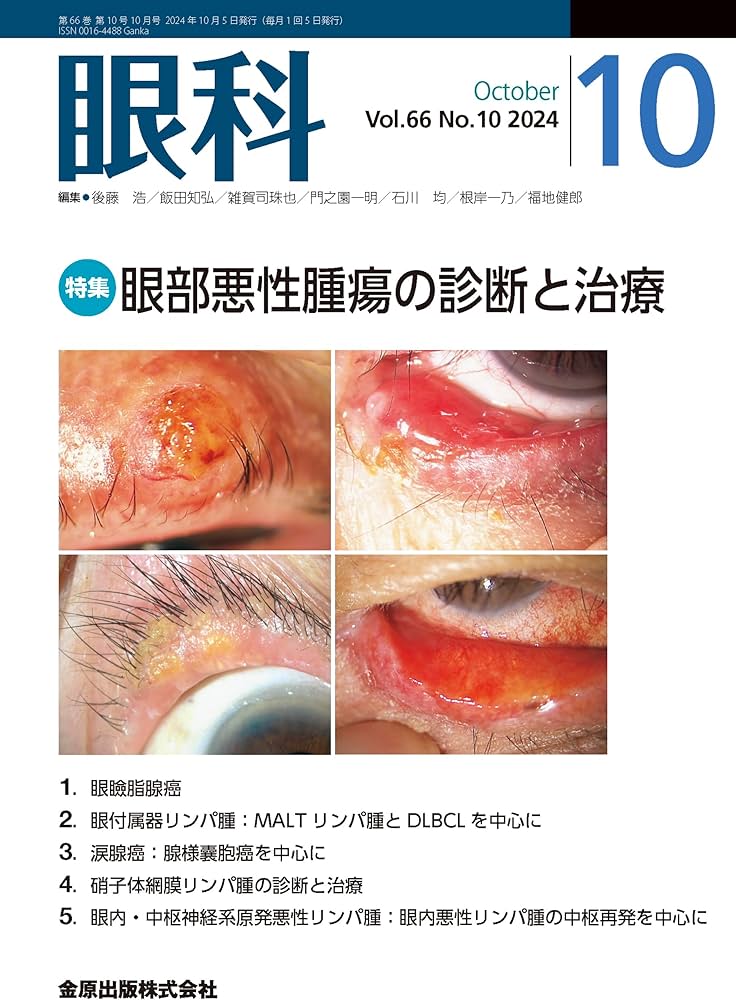 眼科 2024年10月号 眼部悪性腫瘍の診断と治療 | 金原出版 眼科編集室