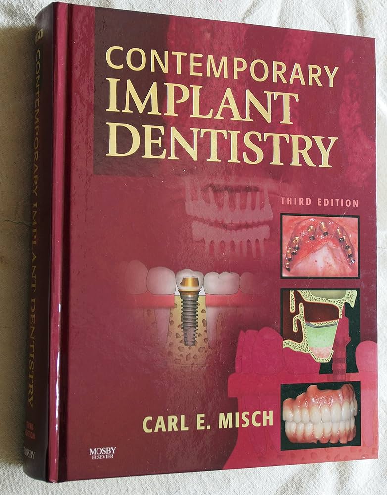 Amazon.co.jp: Contemporary Implant Dentistry : Misch DDS MDS PhD
