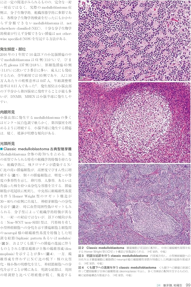 91goQ85EbCL._AC_UF1000,