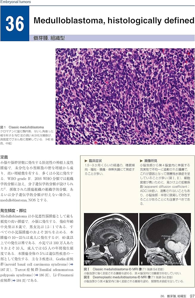 脳腫瘍臨床病理カラーアトラス 第4版 | 日本脳腫瘍病理学会, 若林俊彦