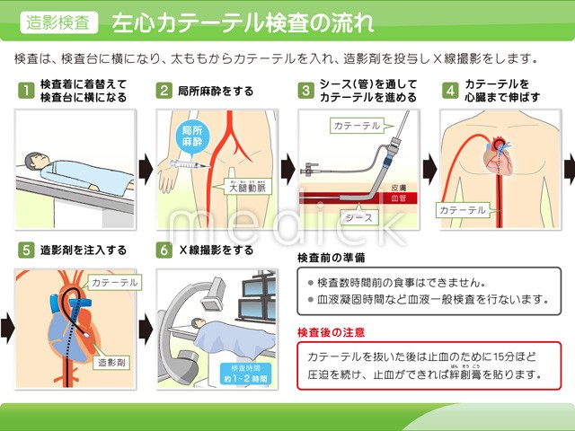 心臓カテーテル検査（造影検査）の流れの説明スライド - 医療の