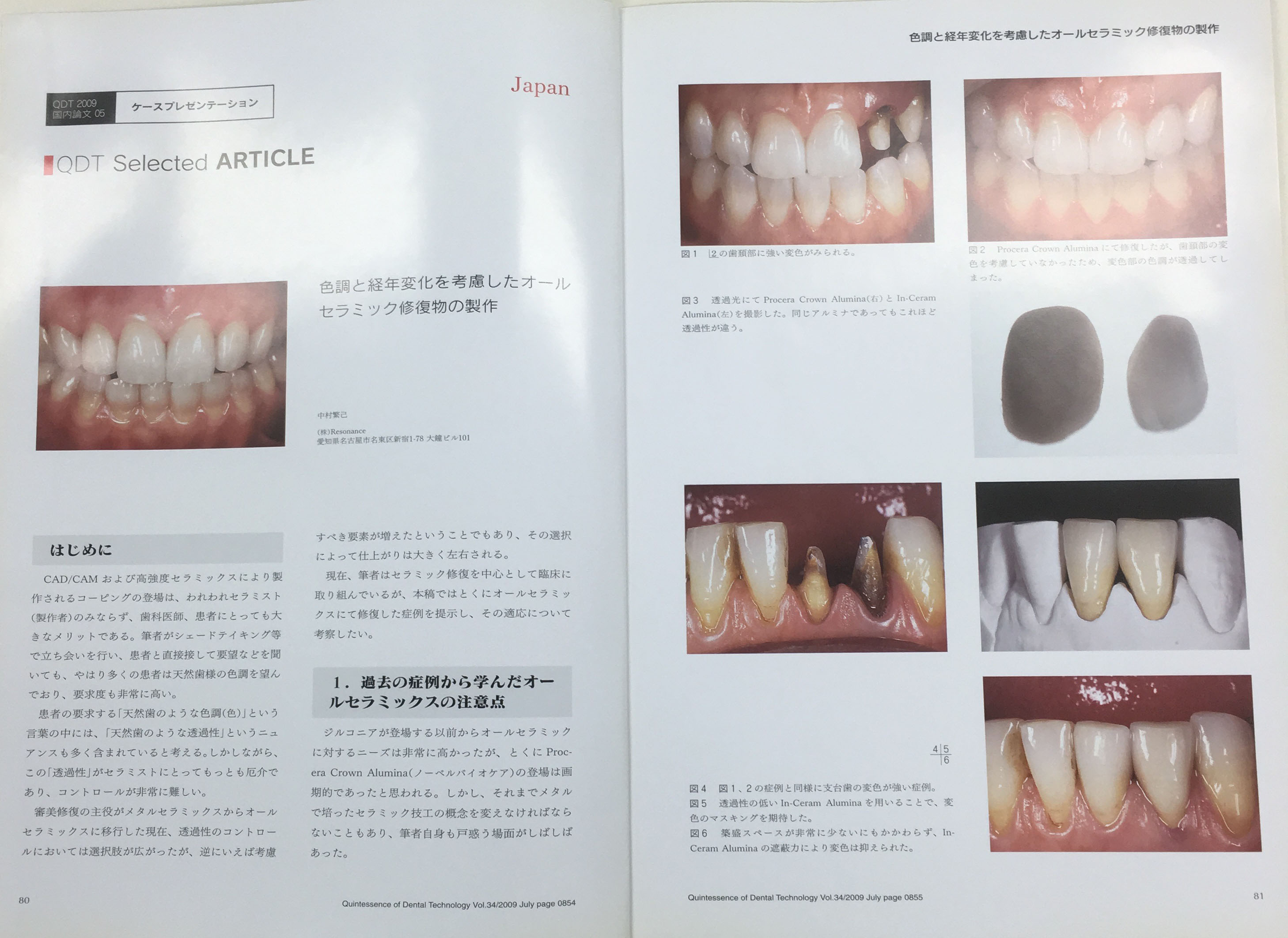 技工士紹介 ｜ 名古屋の審美治療はデンタルサロン モナ|名古屋市西区の